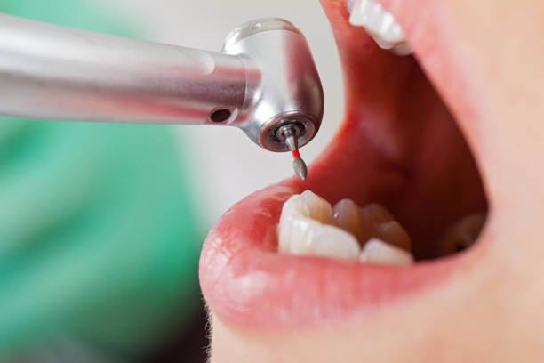 Best Emergency Cosmetic Dentistry (e.g., broken veneers) in Hurley, MS